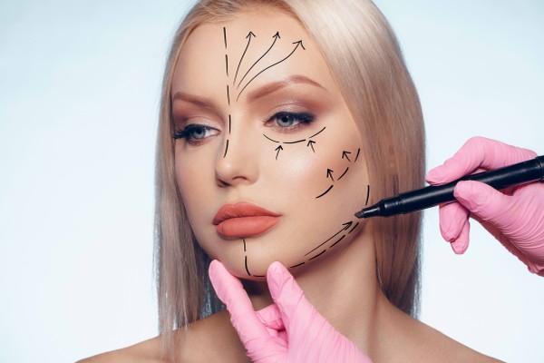Face Lift Face lift Antalya-Facial lift costs