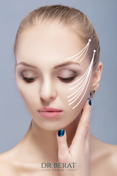 What is a temporal lift? Temporal lift Antalya-Temporal brow lift costs Turkey