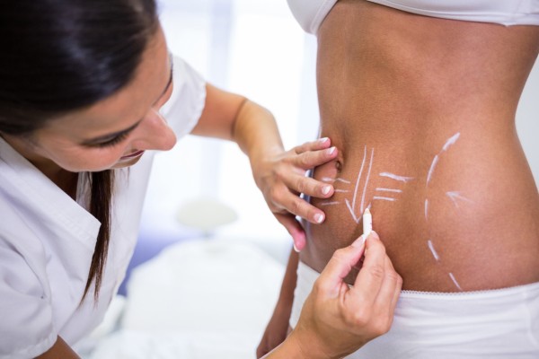 Tummy tuck Tummy tuck cost-Abdominoplasty in Antalya
