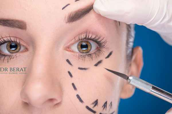 Temporal Brow Lift Key Information Antalya The best age temporal Brow lift Key information Antalya