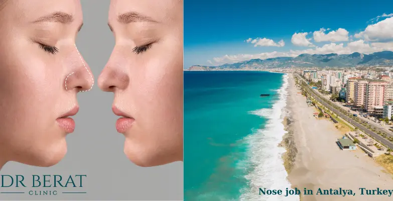 nose job surgery in turkey