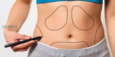 Mammoplasty in Turkey